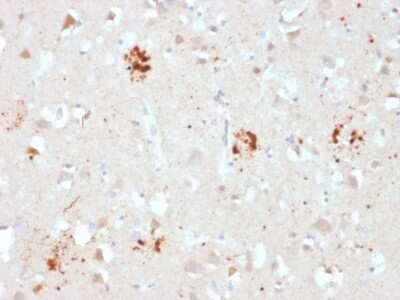 Immunohistochemistry-Paraffin: Ubiquitin B Antibody (UBB/2122) [NBP3-08906] - Formalin-fixed, paraffin-embedded human Brain stained with Ubiquitin B Mouse Monoclonal Antibody (UBB/2122).