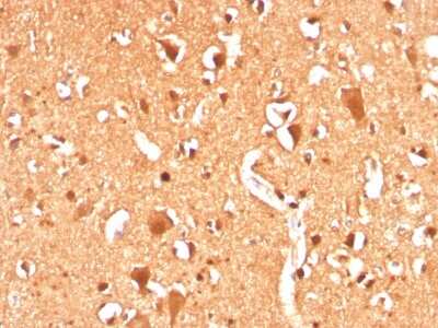 Immunohistochemistry-Paraffin: Ubiquitin B Antibody (UBB/3143R) - Azide and BSA Free [NBP3-08907] - Formalin-fixed, paraffin-embedded human Brain stained with Ubiquitin B Recombinant Rabbit Monoclonal Antibody (UBB/3143R).