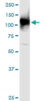 Western Blot: Ubiquitin-activating Enzyme/UBE1 Antibody (2B6) [H00007317-M02] - UBA1 monoclonal antibody (M02), clone 2B6. Analysis of UBA1 expression in HeLa.