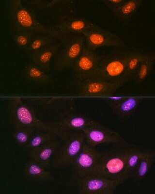 Immunocytochemistry/Immunofluorescence: Ubiquitin-activating Enzyme/UBE1 Antibody (6H2I9) [NBP3-16792] - Immunofluorescence analysis of U-2 OS cells using Ubiquitin-activating Enzyme/UBE1 Rabbit mAb (NBP3-16792) at dilution of 1:100 (40x lens). Blue: DAPI for nuclear staining.