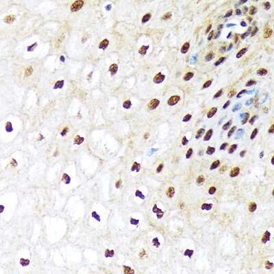 Immunohistochemistry-Paraffin: Ubiquitin-activating Enzyme/UBE1 Antibody (6H2I9) [NBP3-16792] - Immunohistochemistry of paraffin-embedded human esophageal using Ubiquitin-activating Enzyme/UBE1 Rabbit mAb (NBP3-16792) at dilution of 1:100 (40x lens).Perform microwave antigen retrieval with 10 mM Tris/EDTA buffer pH 9.0 before commencing with IHC staining protocol.