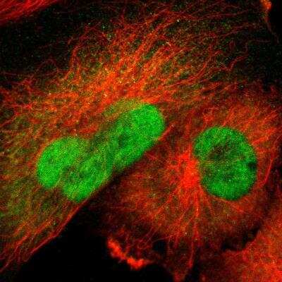 <b>Independent Antibodies Validation. </b>Immunocytochemistry/Immunofluorescence: Ubiquitin-activating Enzyme/UBE1 Antibody [NBP2-76500] - Staining of human cell line U-251 MG shows localization to nucleoplasm & cytosol. Antibody staining is shown in green.