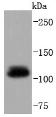 Western Blot: Ubiquitin-activating Enzyme/UBE1 Antibody (SD08-62) [NBP2-67816] - Analysis of UBA1 on mouse liver lysates using anti-UBA1 antibody at 1:5000.