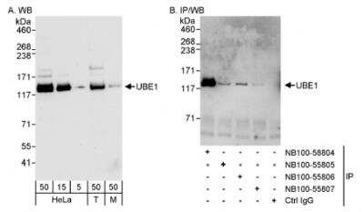 Western Blot: Ubiquitin-activating Enzyme/UBE1 Antibody [NB100-58804] - Detection of Human and Mouse UBE1 on HeLa whole cell lysate using NB100-58804. UBE1 was also IPed efficiently by rabbit anti-UBE1 antibodies NB100-58805 and NB100-58806.