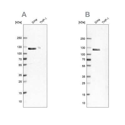 Western Blot: Ubiquitin-activating Enzyme/UBE1 Antibody [NBP1-90307] - Analysis using Anti-UBA1 antibody NBP1-90307 (A) shows similar pattern to independent antibody NBP2-76500 (B).