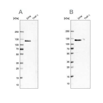 Western Blot: Ubiquitin-activating Enzyme/UBE1 Antibody [NBP2-76500] - Analysis using Anti-UBA1 antibody NBP2-76500 (A) shows similar pattern to independent antibody NBP1-90307 (B).