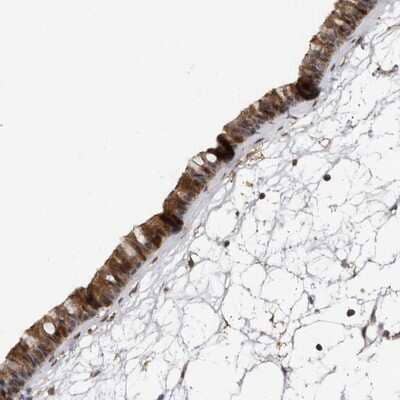 Immunohistochemistry-Paraffin: Ufc1 Antibody [NBP1-81676] - Staining of human nasopharynx shows strong cytoplasmic and nuclear positivity in respiratory epithelial cells.