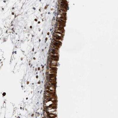 Immunohistochemistry-Paraffin: Ufc1 Antibody [NBP1-81677] - Staining of human nasopharynx shows strong cytoplasmic and membranous positivity in respiratory epithelial cells.