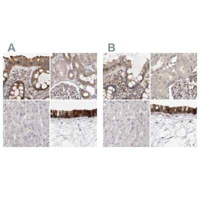 <b>Independent Antibodies Validation. </b>Immunohistochemistry-Paraffin: Ufc1 Antibody [NBP1-81677] - Staining of human colon, kidney, liver and nasopharynx using Anti-UFC1 antibody NBP1-81677 (A) shows similar protein distribution across tissues to independent antibody NBP1-81676 (B).
