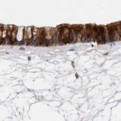 Immunohistochemistry-Paraffin: Ufc1 Antibody [NBP1-81677] - Staining of human nasopharynx.