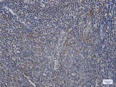 Immunohistochemistry-Paraffin: Ufc1 Antibody (S08-5E1) [NBP3-15107] - Immunohistochemistry of Ufc1 in paraffin-embedded Human tonsil using Ufc1 Rabbit mAb at dilution 1/20