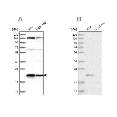 Western Blot: Ufc1 Antibody [NBP1-81676] - Analysis using Anti-UFC1 antibody NBP1-81676 (A) shows similar pattern to independent antibody NBP1-81677 (B).