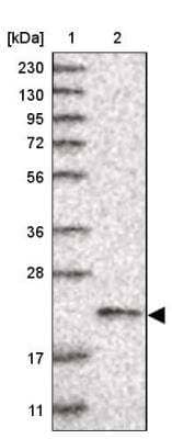 Western Blot: Ufc1 Antibody [NBP1-81677] - Lane 1: Marker  [kDa] 230, 130, 95, 72, 56, 36, 28, 17, 11.  Lane 2: Human cell line RT-619