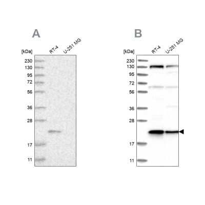 Western Blot: Ufc1 Antibody [NBP1-81677] - Analysis using Anti-UFC1 antibody NBP1-81677 (A) shows similar pattern to independent antibody NBP1-81676 (B).