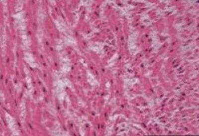 Hematoxylin & Eosin Stain: Umbilical Cord Tissue Slides (Normal) [NBP2-30208] - umbilical cord, normal  Age/Sex : 26/F