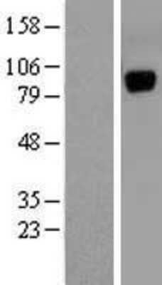 Western Blot: Unc5a Overexpression Lysate (Adult Normal) [NBL1-17616] Left-Empty vector transfected control cell lysate (HEK293 cell lysate); Right -Over-expression Lysate for Unc5a.