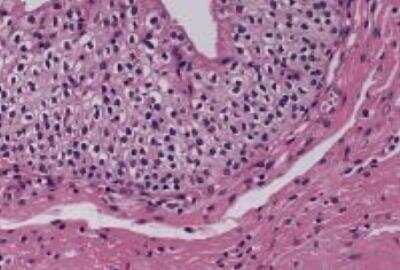 Hematoxylin & Eosin Stain: Ureter Tissue Slides (Normal) [NBP2-30209] -  ureter, normal  Age/Sex : 40/M