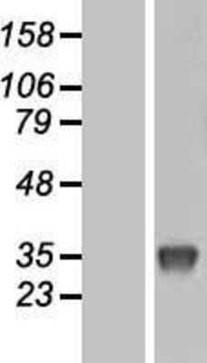 Western Blot: Uridine Phosphorylase 1 Overexpression Lysate (Adult Normal) [NBL1-17625] Left-Empty vector transfected control cell lysate (HEK293 cell lysate); Right -Over-expression Lysate for Uridine Phosphorylase 1.