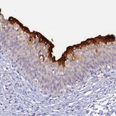 Immunohistochemistry-Paraffin: Uroplakin II Antibody [NBP2-33389] - Staining of human urinary bladder shows high expression.