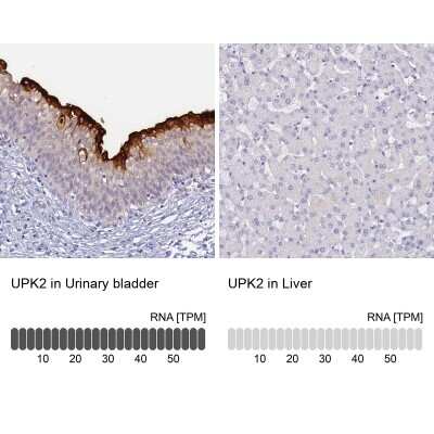 Immunohistochemistry-Paraffin Uroplakin II Antibody - BSA Free