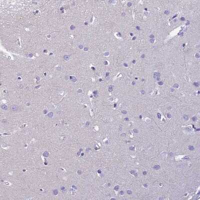 Immunohistochemistry-Paraffin: Uroplakin II Antibody [NBP2-33389] - Staining of human cerebral cortex shows no positivity in neurons as expected.
