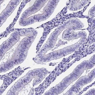 Immunohistochemistry-Paraffin: Uroplakin II Antibody [NBP2-33389] - Staining of human endometrium shows no positivity in glandular cells as expected.