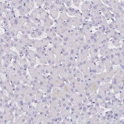 Immunohistochemistry-Paraffin: Uroplakin II Antibody [NBP2-33389] - Staining of human liver shows no positivity in hepatocytes as expected.