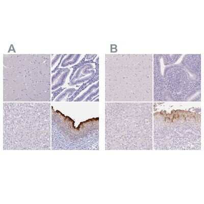 <b>Independent Antibodies Validation and Orthogonal Strategies Validation.</b>Immunohistochemistry-Paraffin: Uroplakin II Antibody [NBP2-33389] - Staining of human cerebral cortex, colon, skeletal muscle and stomach using Anti-PGC antibody (A) NBP2-33389 shows similar protein distribution across tissues to independent antibody NBP2-38904 (B).