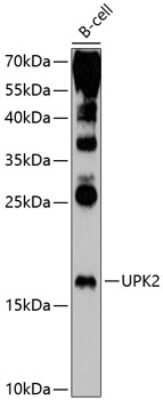 Western Blot: Uroplakin II Antibody [NBP2-94296] - Analysis of extracts of B-cell cells, using UPK2 antibody at 1:1000 dilution.Secondary antibody: HRP Goat Anti-Rabbit IgG (H+L) at 1:10000 dilution.Lysates/proteins: 25ug per lane. Blocking buffer: 3% nonfat dry milk in TBST.Detection: ECL Enhanced Kit. Exposure time: 40s.