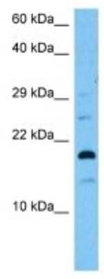 Western Blot: Uroplakin II Antibody [NBP3-10138] - Western blot analysis of Uroplakin II in Mouse Liver lysates. Antibody dilution at 1ug/ml