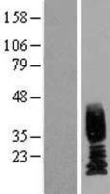 Western Blot Uroplakin II Overexpression Lysate