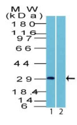 Western Blot: Uroplakin III Antibody [NBP2-29477] - Human HEK293 lysate in the 1) absence and 2) presence of immunizing peptide using Uroplakin III  antibody at 4 ug/ml. Goat anti-rabbit Ig HRP secondary antibody and PicoTect ECL substrate solution were used for this test.