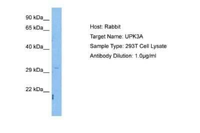Western Blot: Uroplakin III Antibody [NBP2-88549] - Host: Rabbit. Target Name: UPK3A. Sample Tissue: Human 293T Whole Cell. Antibody Dilution: 1.0ug/ml