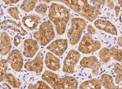 Immunohistochemistry-Paraffin: Uroplakin IIIB Antibody [NBP3-06026] - Staining of human UPK3B in human kidney with rabbit polyclonal antibody at 1:100 dilution.