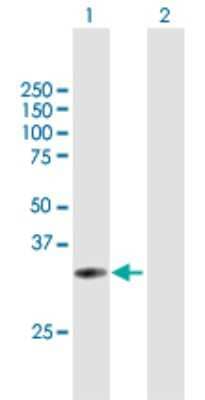 Western Blot: Uroplakin IIIB Antibody [H00080761-B01P] - Analysis of UPK3B expression in transfected 293T cell line by UPK3B polyclonal antibody.  Lane 1: UPK3B transfected lysate(35.2 KDa). Lane 2: Non-transfected lysate.