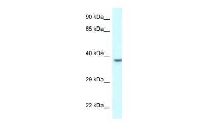 Western Blot: Uroplakin IIIB Antibody [NBP2-86046] - WB Suggested Anti-UPK3B Antibody. Titration: 1.0 ug/ml. Positive Control: 721_B Whole Cell