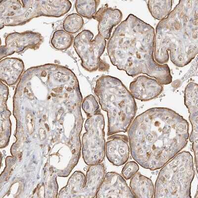 Immunohistochemistry-Paraffin: Uroplakin Ib Antibody [NBP1-80657] - Staining of human placenta shows moderate membranous positivity in trophoblastic cells.