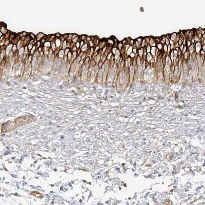 Immunohistochemistry-Paraffin: Uroplakin Ib Antibody [NBP1-80657] - Staining of human urinary bladder shows strong membranous positivity in urothelial cells.