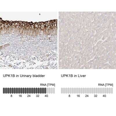 Immunohistochemistry-Paraffin: Uroplakin Ib Antibody [NBP1-80657] - Staining in human urinary bladder and liver tissues using NBP1-80657 antibody. Corresponding UPK1B RNA-seq data are presented for the same tissues.