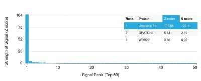 Protein Array: Uroplakin Ib Antibody (UPK1B/3102) [NBP2-79800] - Analysis of Protein Array containing more than 19,000 full-length human proteins using Uroplakin Ib Antibody (UPK1B/3102) Z- and S- Score: The Z-score represents the strength of a signal that a monoclonal antibody (MAb) (in combination with a fluorescently-tagged anti-IgG secondary antibody) produces when binding to a particular protein on the HuProt(TM) array. Z-scores are described in units of standard deviations (SD's) above the mean value of all signals generated on that array. If targets on HuProt(TM) are arranged in descending order of the Z-score, the S-score is the difference (also in units of SD's) between the Z-score. S-score therefore represents the relative target specificity of a MAb to its intended target. A MAb is considered to specific to its intended target, if the MAb has an S-score of at least 2.5.