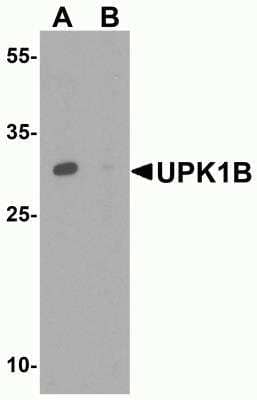 Western Blot: Uroplakin Ib Antibody [NBP2-81768] - Analysis of Uroplakin Ib in human kidney tissue lysate with Uroplakin Ib antibody in (A) the absence and (B) the presence of blocking peptide.