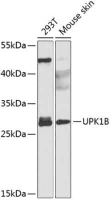 Western Blot: Uroplakin Ib Antibody [NBP2-93853] - Analysis of extracts of various cell lines, using Uroplakin Ib at 1:1000 dilution. Secondary antibody: HRP Goat Anti-Rabbit IgG (H+L) at 1:10000 dilution. Lysates/proteins: 25ug per lane. Blocking buffer: 3% nonfat dry milk in TBST. Detection: ECL Basic Kit . Exposure time: 90s.