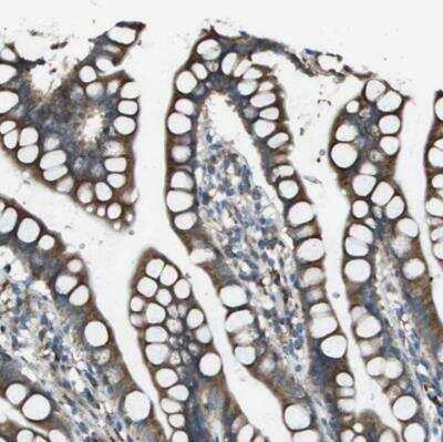 Immunohistochemistry-Paraffin: Urotensin-2 Antibody [NBP1-87223] - Staining of human small intestine shows distinct cytoplasmic positivity in glandular cells.