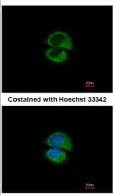 Immunocytochemistry/Immunofluorescence: Use1 Antibody [NBP2-20822] - Immunofluorescence analysis of methanol-fixed MCF-7, using antibody at 1:500 dilution.