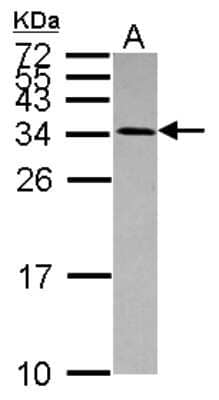 Western Blot: Use1 Antibody [NBP2-20822] - Sample (30 ug of whole cell lysate) A: NT2D1 15% SDS PAGE gel, diluted at 1:1000.