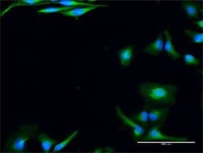 Immunocytochemistry/Immunofluorescence: Use1/UBE2Z Antibody [H00055850-D01P] - Analysis of antibody to USE1 on HeLa cell. Antibody concentration 20 ug/ml.
