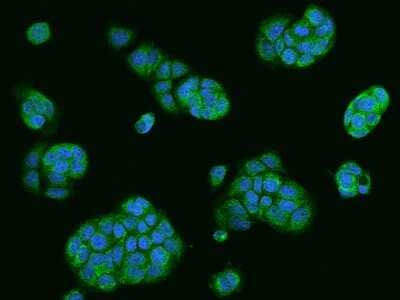 Immunocytochemistry/Immunofluorescence: Use1/UBE2Z Antibody [NBP2-97553] - Immunofluorescence staining of Use1/UBE2Z in MCF7 cells. Cells were fixed with 4% PFA, permeabilzed with 0.1% Triton X-100 in PBS, blocked with 10% serum, and incubated with rabbit anti-Human Use1/UBE2Z polyclonal antibody (dilution ratio 1:200) at 4C overnight. Then cells were stained with the Alexa Fluor(R)488-conjugated Goat Anti-rabbit IgG secondary antibody (green) and counterstained with DAPI (blue).Positive staining was localized to Cytoplasm.