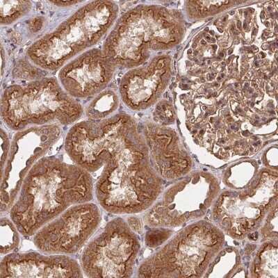 Immunohistochemistry: Use1/UBE2Z Antibody [NBP2-38568] - Staining of human kidney shows strong cytoplasmic and membranous positivity in cells in tubules.