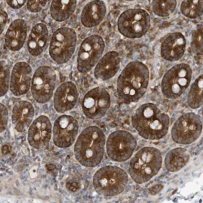 Immunohistochemistry-Paraffin: Use1/UBE2Z Antibody [NBP1-82785] - Staining of human duodenum shows strong cytoplasmic positivity in glandular cells.