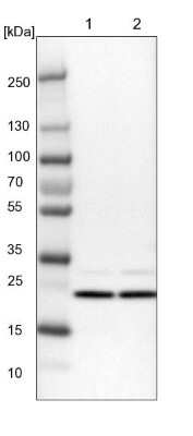 Western Blot: Use1/UBE2Z Antibody [NBP1-82785] - Lane 1: NIH-3T3 cell lysate (Mouse embryonic fibroblast cells)Lane 2: NBT-II cell lysate (Rat Wistar bladder tumour cells)